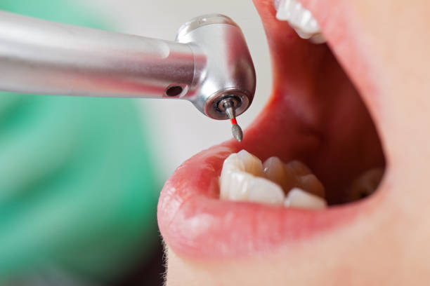 Best Dental Abscess Treatment in Hutto, TX